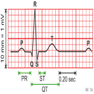 ECG Interpreter
